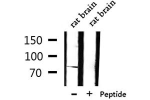 Western blot analysis of extracts from rat brain, using TLE1 Antibody. (TLE1 antibody  (Internal Region))