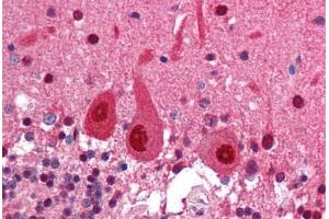 Human Brain, Cerebellum (formalin-fixed, paraffin-embedded) stained with COPS5 antibody ABIN214239 at 5 ug/ml followed by biotinylated anti-mouse IgG secondary antibody ABIN481714, alkaline phosphatase-streptavidin and chromogen.