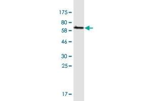 Western Blot detection against Immunogen (60. (GIPC2 antibody  (AA 1-315))