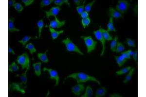 Immunofluorescence staining of A549 cells with ABIN7169627 at 1:133, counter-stained with DAPI. (SPPL2B antibody  (AA 492-592))