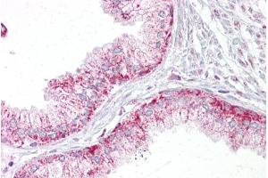 Immunohistochemistry with Prostate tissue at an antibody concentration of 5µg/ml using anti-AURKA antibody (ARP30876_P050) (Aurora A antibody  (C-Term))