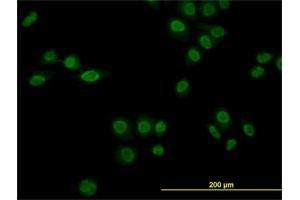 Immunofluorescence of monoclonal antibody to NR1D1 on HeLa cell. (NR1D1 antibody  (AA 1-614))