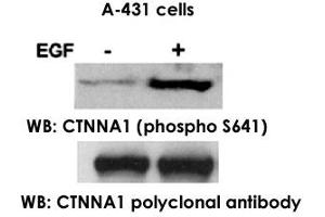 Western blot analysis of extract from A-431 cells, untreated ortreated with EGF (200ng/ml, 30min), using CTNNA1 polyclonal antibody  and CTNNA1 (phospho S641) polyclonal antibody . (CTNNA1 antibody  (pSer641))