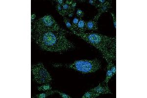 Confocal immunofluorescent analysis of NOTCH3 Antibody (C-term) (ABIN390159 and ABIN2840656) with HepG2 cell followed by Alexa Fluor 488-conjugated goat anti-rabbit lgG (green). (NOTCH3 antibody  (C-Term))