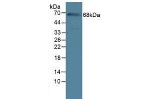Detection of IL23R in Rat Serum Tissue using Polyclonal Antibody to Interleukin 23 Receptor (IL23R) (IL23R antibody  (AA 25-355))