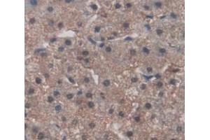 IHC-P analysis of Human Tissue, with DAB staining. (FNDC5 antibody  (AA 2-137))