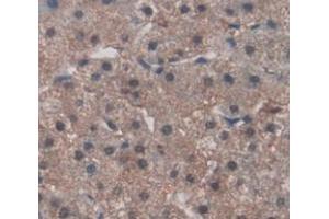 IHC-P analysis of Human Tissue, with DAB staining. (FNDC5 antibody  (AA 2-137))