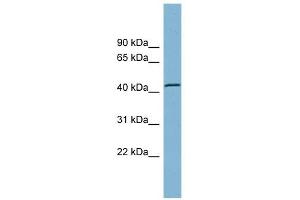 TBC1D13 antibody used at 1 ug/ml to detect target protein. (TBC1D13 antibody  (Middle Region))