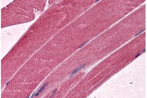 Human Skeletal muscle: Formalin-Fixed, Paraffin-Embedded (FFPE) (MBNL1 antibody  (AA 1-383))