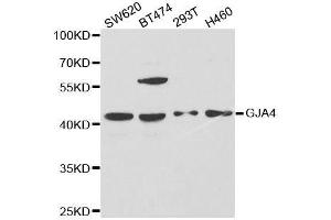 Western blot analysis of extracts of various cell lines, using GJA4 antibody. (GJA4 antibody  (AA 229-333))