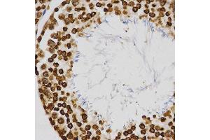 Immunohistochemistry (IHC) image for anti-Histone H4 (3meLys20) antibody (ABIN3016051) (Histone H4 antibody  (3meLys20))