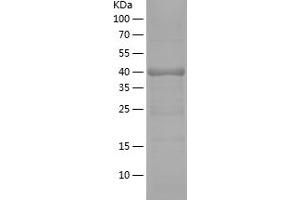 Western Blotting (WB) image for Adenylate Cyclase 3 (ADCY3) (AA 400-576) protein (His-IF2DI Tag) (ABIN7121714) (ADCY3 Protein (AA 400-576) (His-IF2DI Tag))