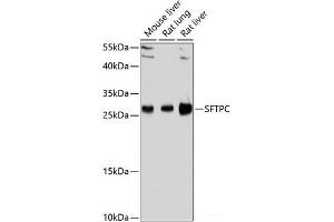 Western blot analysis of extracts of various cell lines using SFTPC Polyclonal Antibody at dilution of 1:1000. (Surfactant Protein C antibody)