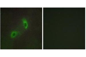 Immunofluorescence analysis of HUVEC cells, using HGS antibody. (HGS antibody  (Internal Region))