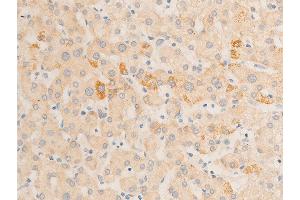 Immunohistochemistry (IHC) image for anti-Nuclear Factor-kB p65 (NFkBP65) (pSer536) antibody (ABIN6255402)