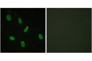 Immunofluorescence analysis of HeLa cells, using Androgen Receptor (Ab-94) Antibody. (Androgen Receptor antibody  (AA 66-115))