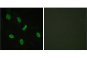 Immunofluorescence (IF) image for anti-Androgen Receptor (AR) (AA 66-115) antibody (ABIN1532498)