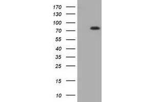 HEK293T cells were transfected with the pCMV6-ENTRY control (Left lane) or pCMV6-ENTRY C17orf28 (Right lane) cDNA for 48 hrs and lysed. (HID1/DMC1 antibody)