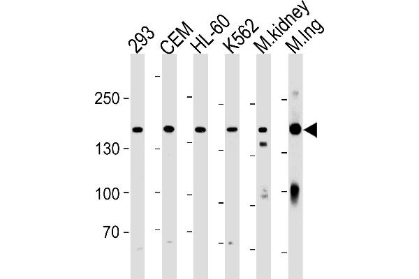 Plakophilin 4 antibody  (C-Term)