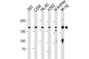 PKP4 Antibody (C-term) (ABIN1881657 and ABIN2843435) western blot analysis in 293,CEM,HL-60,K562 cell line and mouse kidney,lung tissue lysates (35 μg/lane). (Plakophilin 4 antibody  (C-Term))