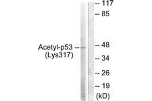 Western blot analysis of extracts from HeLa cells, treated with TSA 400nM 24h, using p53 (Acetyl-Lys317) Antibody. (p53 antibody  (acLys317))