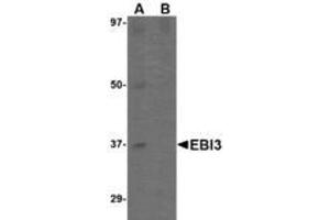 Image no. 2 for anti-Interleukin-27 subunit beta (IL-27b) (C-Term) antibody (ABIN341717) (EBI3 antibody  (C-Term))
