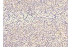 SLC17A3 antibody  (AA 1-125)