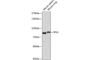 Western blot analysis of extracts of various cell lines, using IFI16 antibody (ABIN6129036, ABIN6142162, ABIN6142163 and ABIN6218202) at 1:1000 dilution.