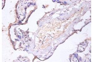 Immunohistochemistry of paraffin-embedded human placenta tissue using ABIN7147519 at dilution of 1:100 (CHMP2A antibody  (AA 1-222))
