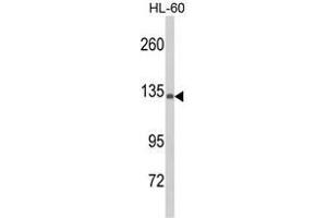Western blot analysis of C5 Antibody (C5 antibody  (N-Term))