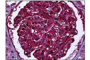 Immunohistochemistry (IHC) image for anti-Myosin 9 (MYH9) antibody (ABIN782310) (Myosin 9 antibody)