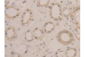 DAB staining on IHC-P; Samples: Human Kidney Tissue (BLMH antibody  (AA 213-447))