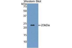 Detection of Recombinant FBN1, Rat using Polyclonal Antibody to Fibrillin 1 (FBN1) (Fibrillin 1 antibody  (AA 168-364))