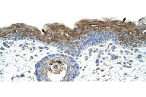 Immunohistochemical staining (Formalin-fixed paraffin-embedded sections) of human skin with EIF2A polyclonal antibody  at 4-8 ug/mL working concentration. (EIF2A antibody  (C-Term))