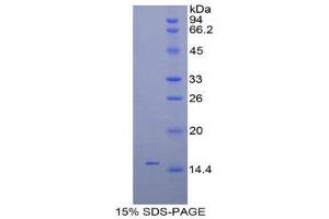 SDS-PAGE (SDS) image for Inhibin, beta C (INHBC) (AA 237-352) protein (His tag) (ABIN2121295)