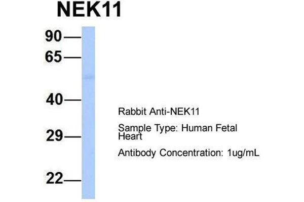 NEK11 antibody  (Middle Region)