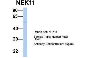 Host:  Rabbit  Target Name:  NEK11  Sample Type:  Human Fetal Heart  Antibody Dilution:  1.