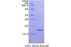 SDS-PAGE (SDS) image for Kininogen 1 (KNG1) ELISA Kit (ABIN6730868)