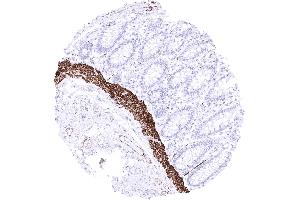 Rectum Strong desmin staining of lamina muscularis mucosae (Recombinant Desmin antibody)