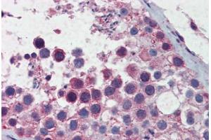 Human Testis: Formalin-Fixed, Paraffin-Embedded (FFPE) (SMC3 antibody  (AA 1051-1100))