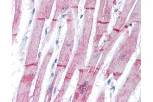 IHC-P Image Immunohistochemical analysis of paraffin-embedded human heart, using alpha Actinin 2, antibody(10 μg/ml).
