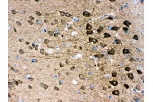 Anti- PGP9. (UCHL1 antibody  (C-Term))