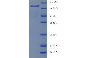 SDS-PAGE (SDS) image for Phospholipase C, delta 4 (PLCD4) (AA 1-762), (full length) protein (His-SUMO Tag) (ABIN4975902)