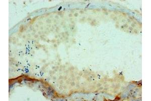 Immunohistochemistry of paraffin-embedded human testis tissue using ABIN7166161 at dilution of 1:100 (SSX2 antibody  (AA 1-188))