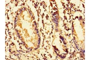 Immunohistochemistry of paraffin-embedded human appendix tissue using ABIN7142262 at dilution of 1:100 (MRPS28 antibody  (AA 72-187))