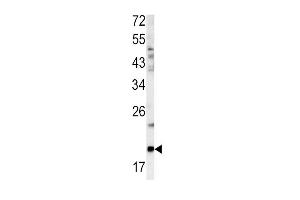 Western blot analysis of GCG antibody (N-term) (ABIN390411 and ABIN2840800) in mouse bladder tissue lysates (35 μg/lane). (Glucagon antibody  (N-Term))
