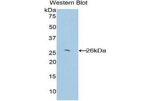 Western Blotting (WB) image for anti-Glutathione S-Transferase kappa 1 (GSTK1) (AA 20-214) antibody (ABIN1859090) (GSTK1 antibody  (AA 20-214))