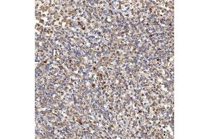 IHC analysis of Mitochondrial Dicarboxylate Carrier/SLC25A10 using anti-Mitochondrial Dicarboxylate Carrier/SLC25A10 antibody (ABIN7601497).