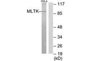 Western blot analysis of extracts from HeLa cells, using MLTK Antibody. (ZAK antibody  (AA 701-750))