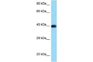 WB Suggested Anti-CD72 Antibody Titration: 1. (CD72 antibody  (C-Term))